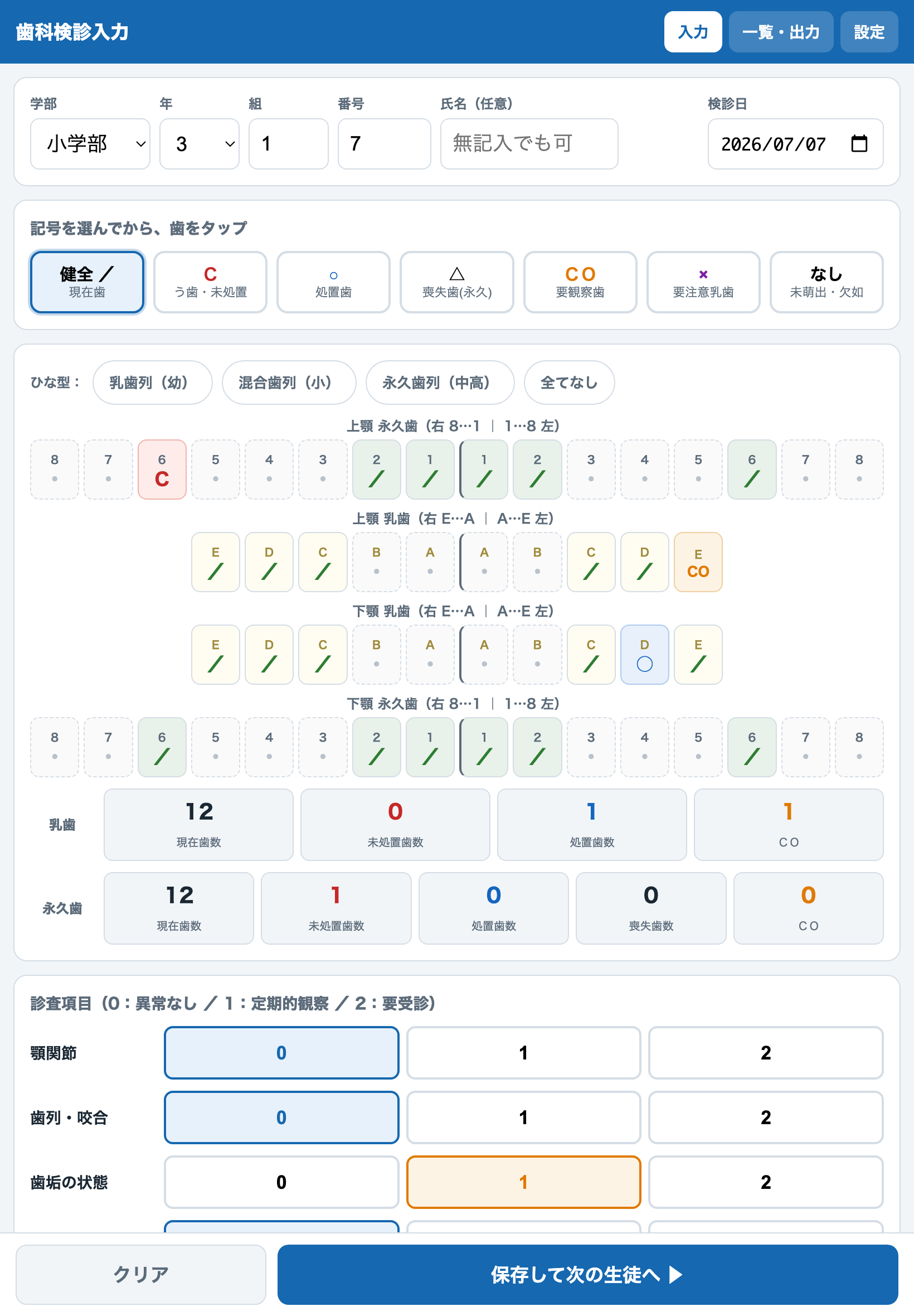歯科検診入力アプリの画面。歯式が並び、記号を選んで歯をタップして入力する